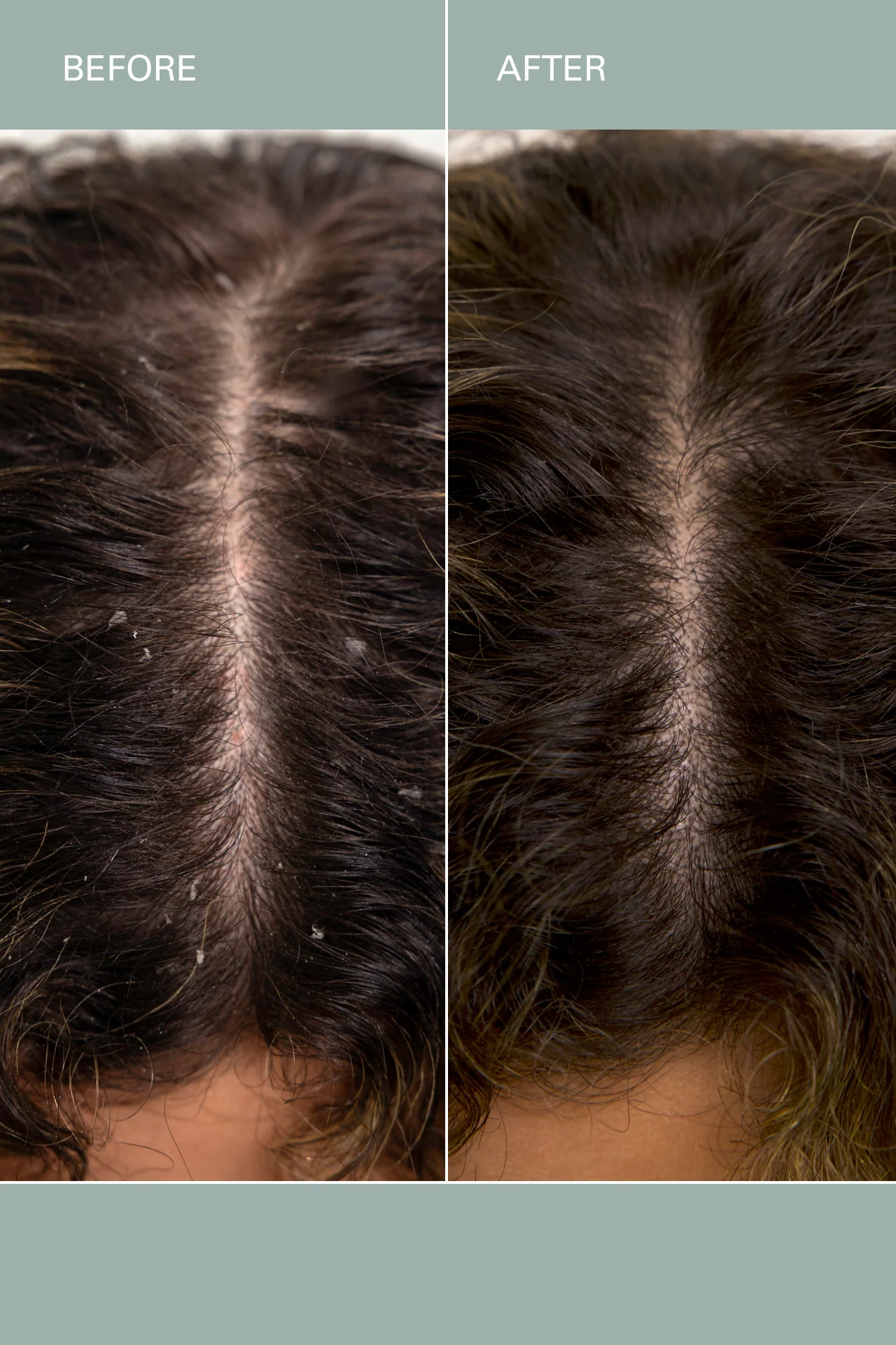 Salt Scalp Scrub - Image 4